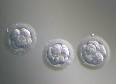 оплодотворенные яйцеклетки