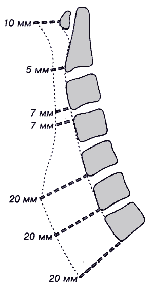 ширина контура превертебральных тканей