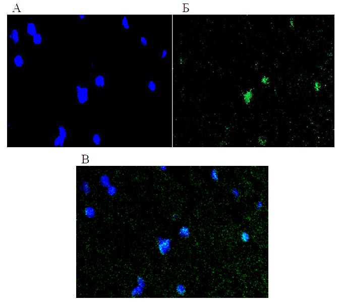 HNu+-клетки в сером веществе спинного мозга