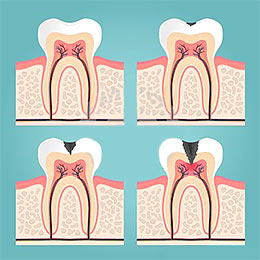 зубные болезни