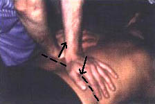 Воздействие проводят по всей длине грудного отдела, на каждом сегменте позвоночника, сверху вниз, в краниосакральном направлении